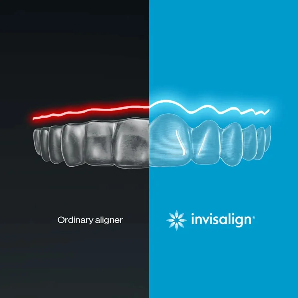 Braces vs Invisalign