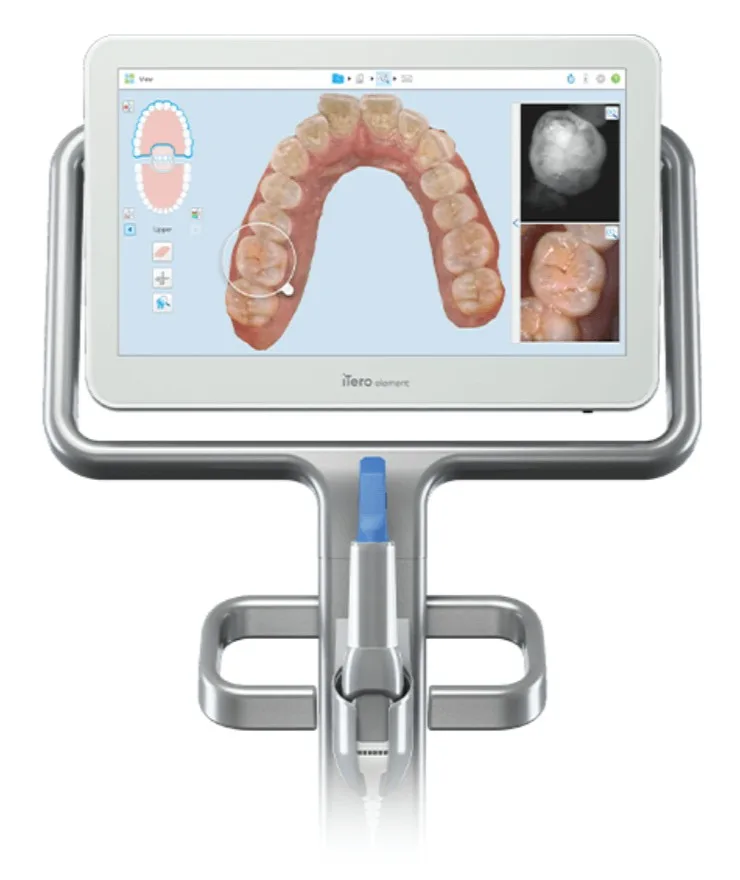 Dentist using iTero scanner