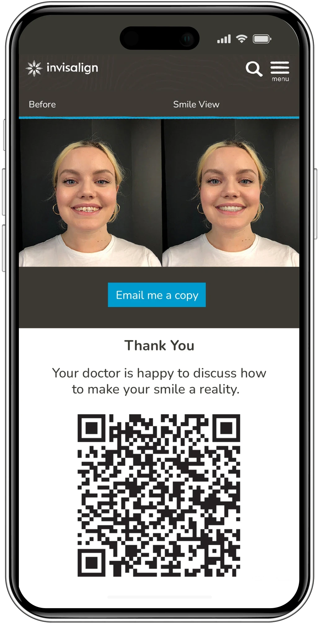 Invisalign Smile Simulator QR
