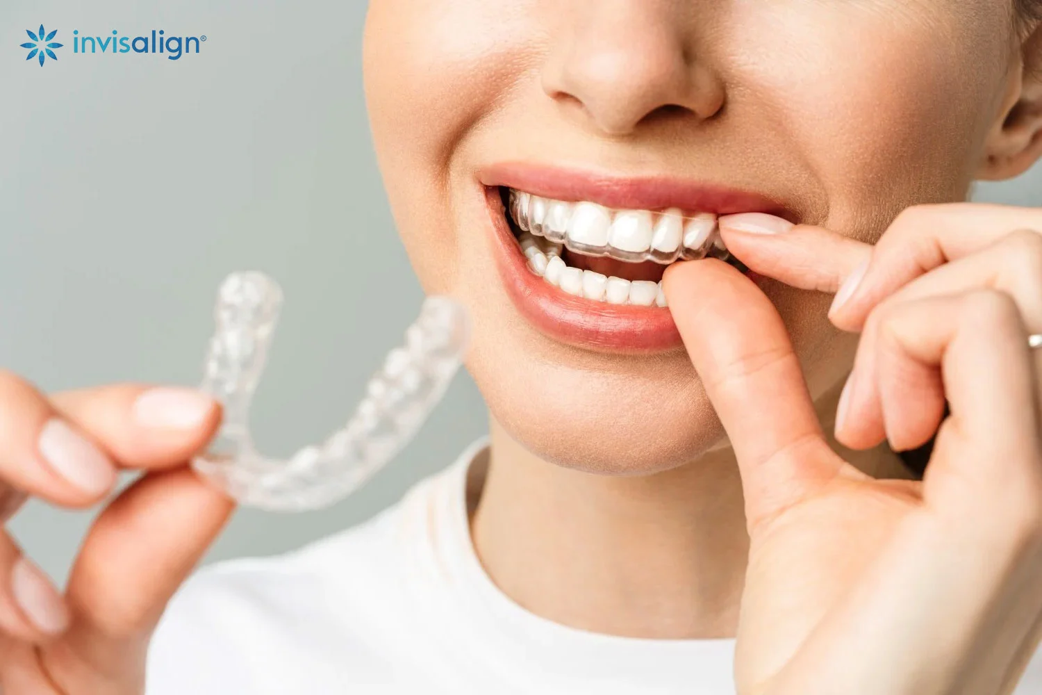Patient smiling with Invisalign